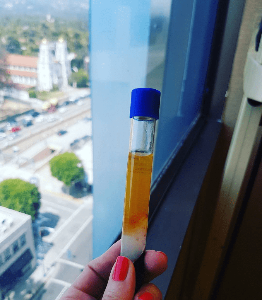 extracted prp