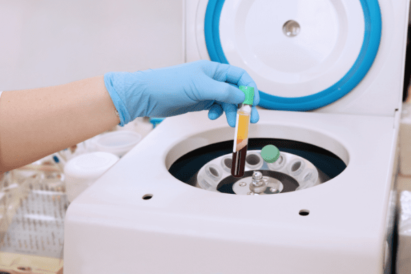 prp centrifuge extraction