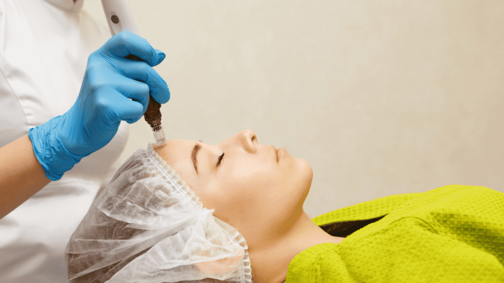 Micro Needling Training for Doctors & Nurses in Beverly Hills, CA